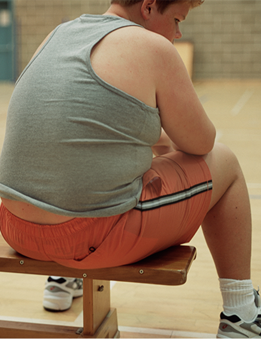 청소년 비만 치료 컨셉 이미지